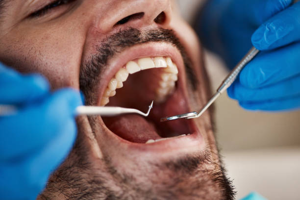 Best Broken or Cracked Tooth Emergency Dentist in Larimore, ND