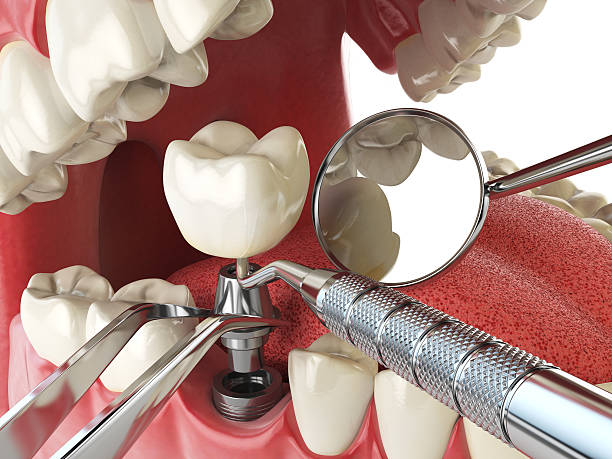 Best Orthodontic Emergency Dentist in Larimore, ND