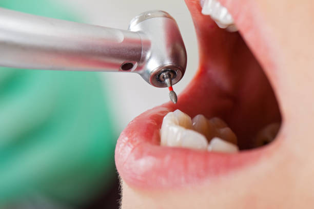 Best Mobile Emergency Dentist in Larimore, ND